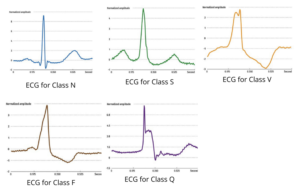 Classification of different ECG patterns
